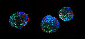 King's College London