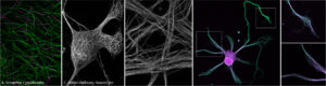 NeuroCyto Lab at INP, CNRS/Aix-Marseille University