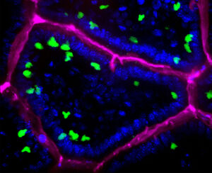 Icahn School of Medicine at Mount Sinai