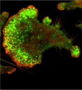 Washington University in St. Louis, School of Medicine